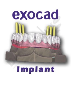 Exocad - Flex Licence - ADD...
